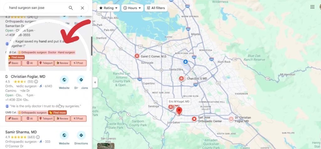 Google Map Pack for San Jose hand surgeons